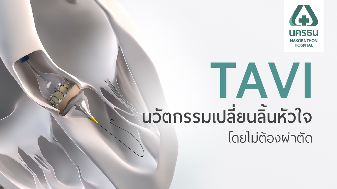 เทคนิคเปลี่ยนลิ้นหัวใจผ่านสายสวน (TAVI) และไบเพลน ลดความเจ็บปวดไร้แผลผ่าตัด